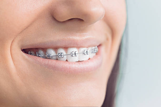 Best Sedation Dentistry  in Wellsville, MO